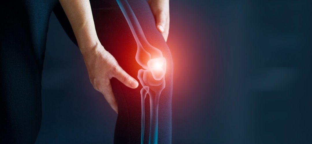 The Power of Exercise for Osteoarthritis Management