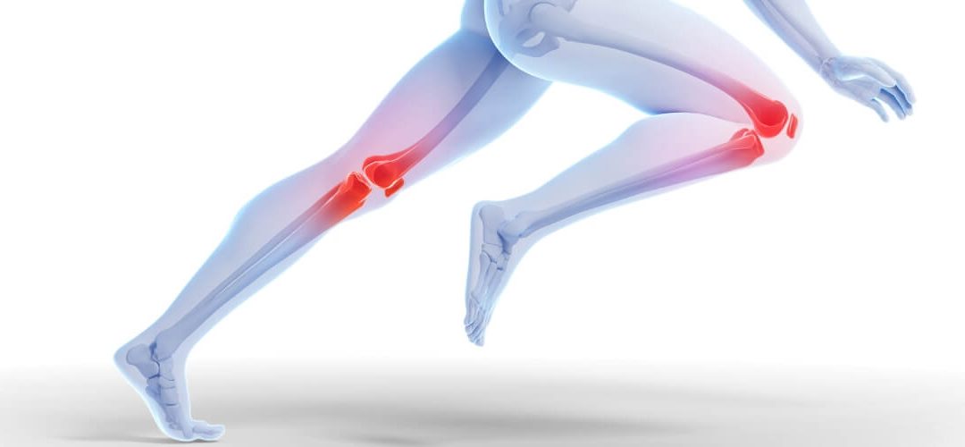 Exercises for Knee Pain: A Key to Managing Knee Osteoarthritis