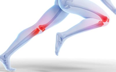 Exercises for Knee Pain: A Key to Managing Knee Osteoarthritis