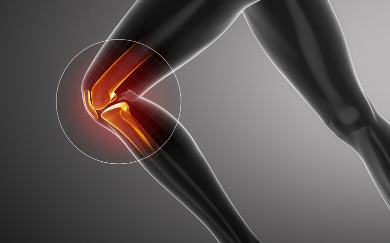 Patellofemoral pain exercises